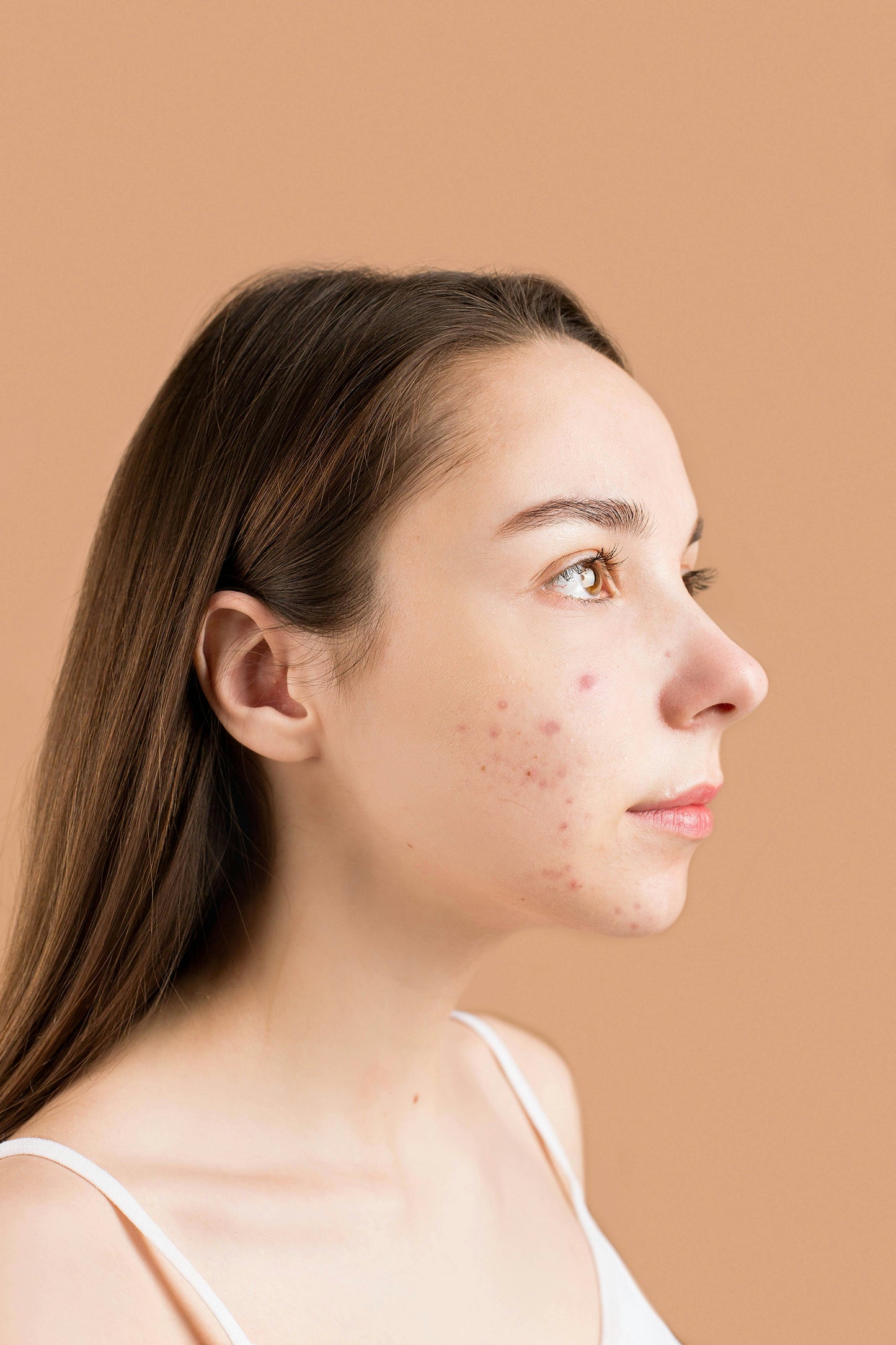 Teen Anti-Acne Facial