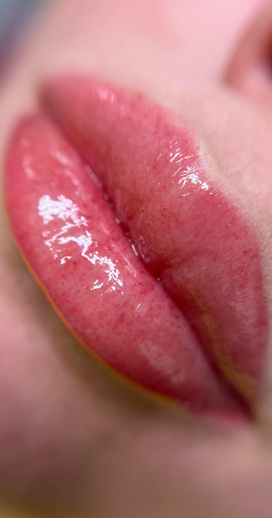 Lip Micropigmentation