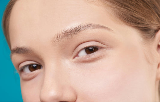 Full Under-Eye Filler